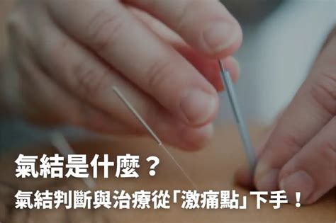 氣脈氣結樣子|氣結是什麼？激痛點如何產生？避開5地雷預防肌筋膜。